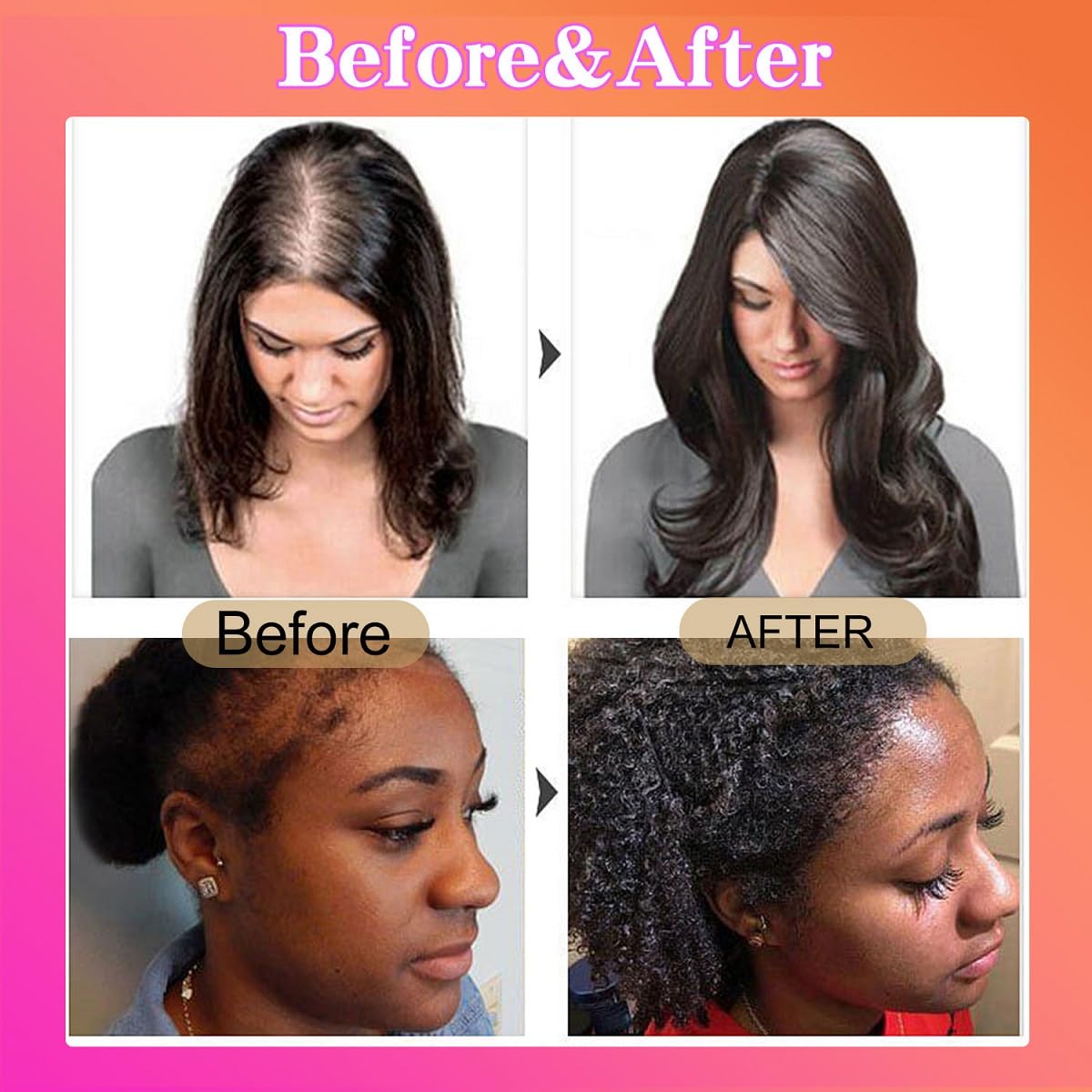 Raw Batana Oil for Hair Growth,Natural,Pure,Unrefined and Organic Dr. Sebi Batana Oil from Honduras,Repair Hair Split End for Men & Women(120ML)