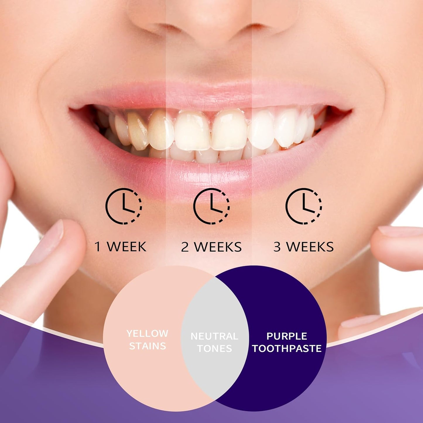 HI SMILE V 34 Toothpaste for Teeth Whitening, Color Correcting Purple Toothpaste Whitening, Removal Stain for Adult Yellow Teeth, Instant Brighten Tooth