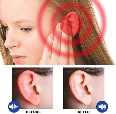 Tinnidrop Tinnitus Relief Spray, Tinnitus Relief for Ringing Ears, Ear Care Tinnitus Relief Products, Relieves Tinnitus, Ear Discomfort